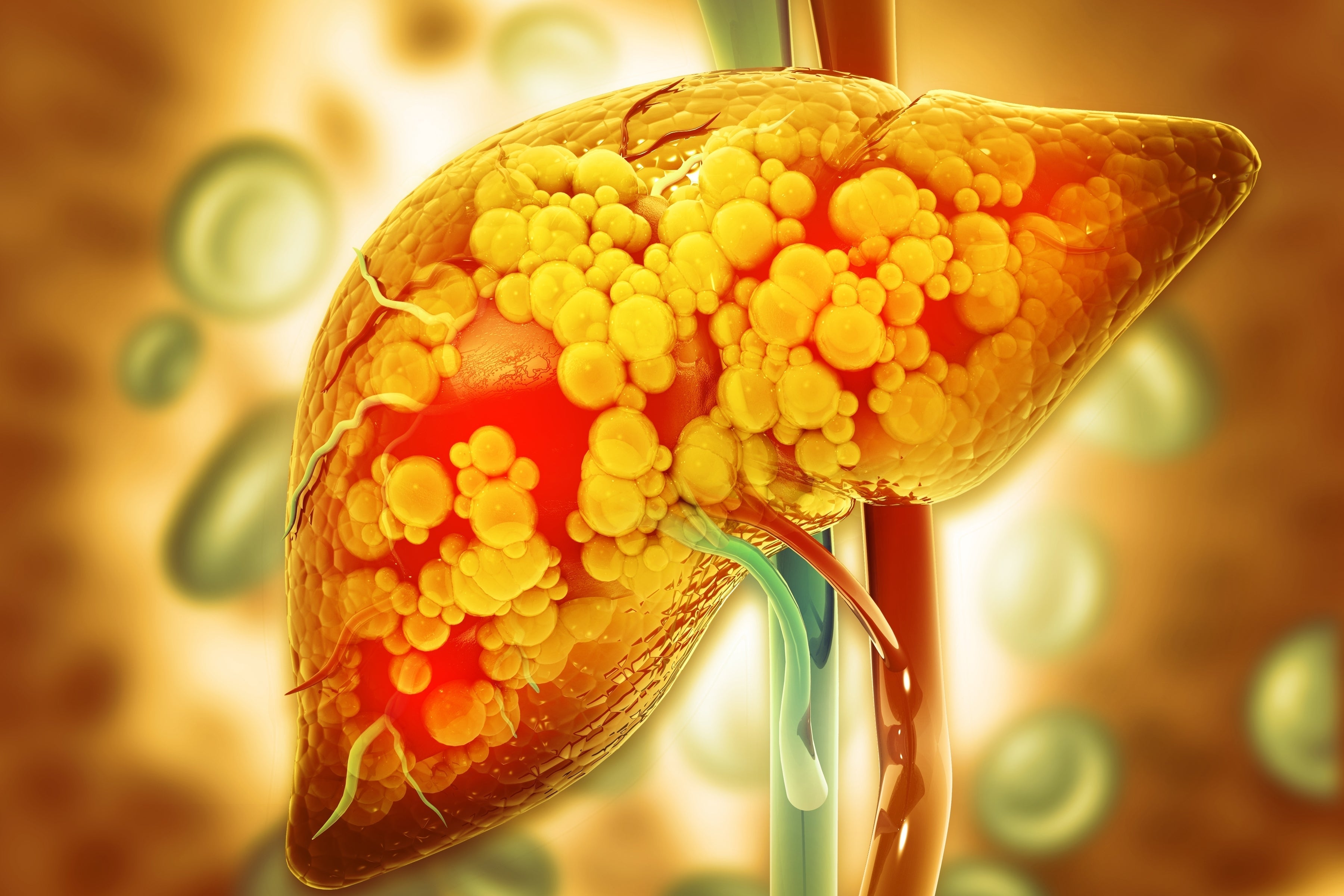 The Hidden Danger: How Visceral Fat Affects Your Liver and Heart